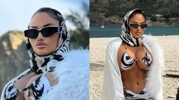 Laluna pręży PŁASKI BRZUCH po operacji zmniejszenia żołądka i przypomina: "Nikt nie jest w stanie mnie zniszczyć" (FOTO)