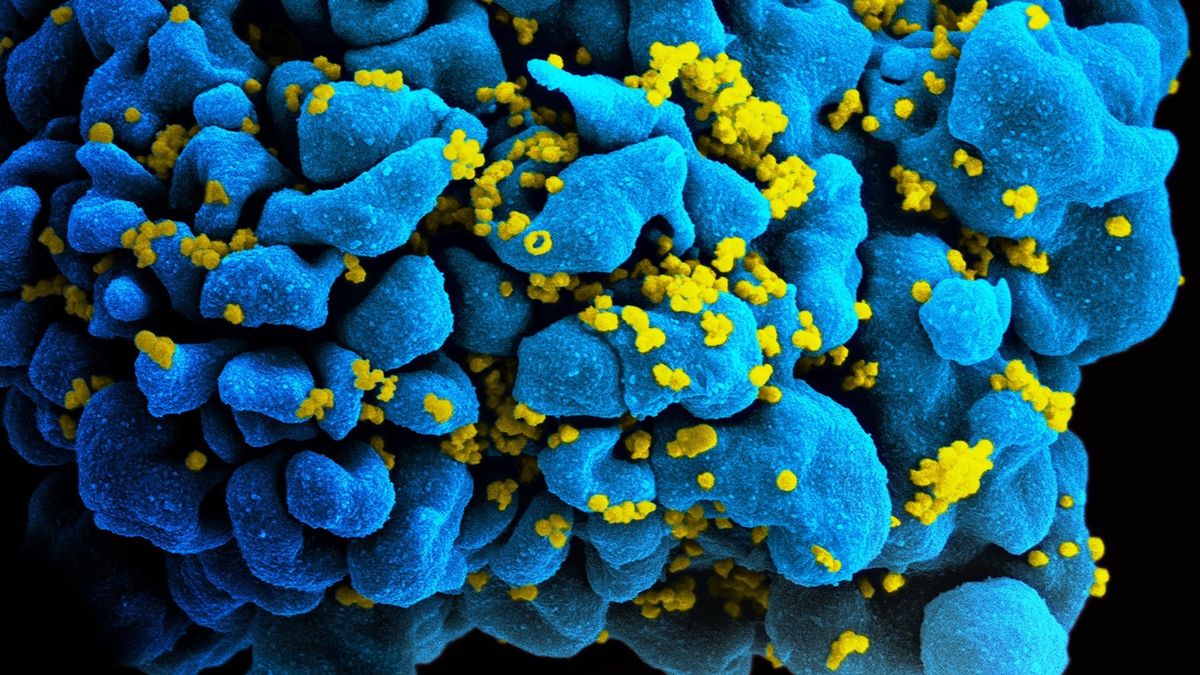 Limfocyty T zakażone wirusem HIV