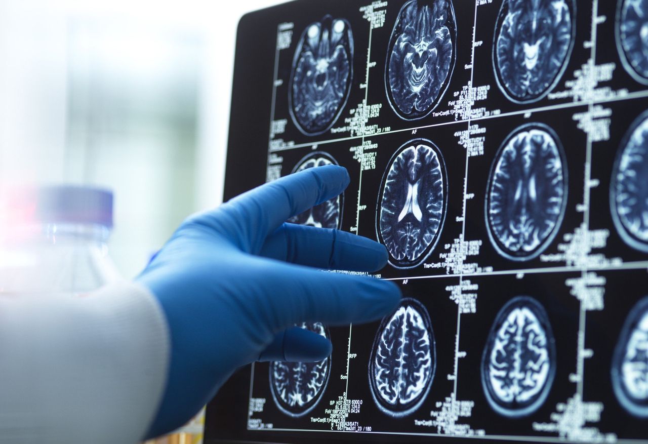 Epoki rozwoju mózgu. Tak zmienia się jego działanie przez całe życie