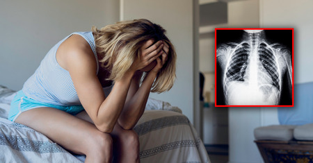 Nigdy nie paliła. Tak u 32-latki objawił się nowotwór płuc