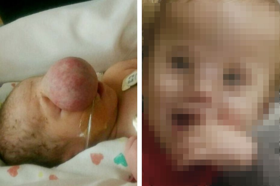 Przez 5 miesięcy nie widziała twarzy dziecka. Lekarze dokonali cudu