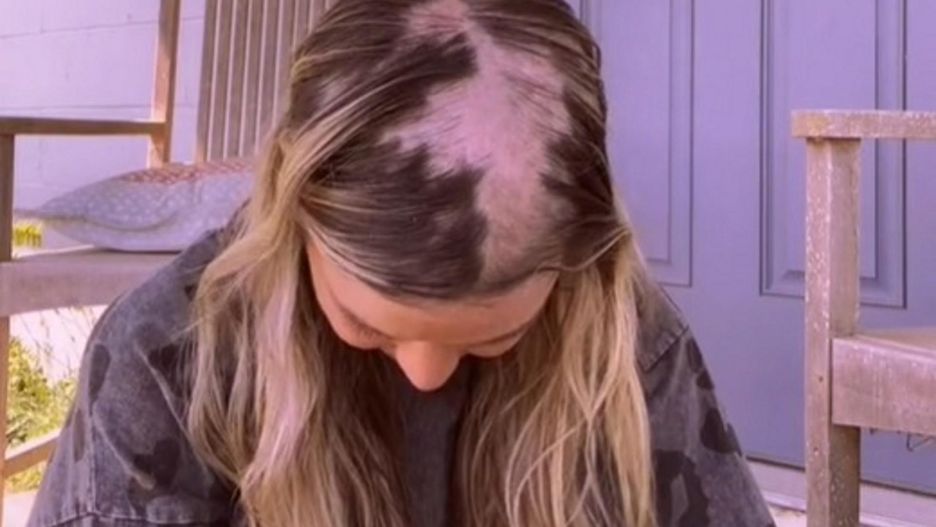 Skutki uboczne przyjmowania tabletek antykoncepcyjnych