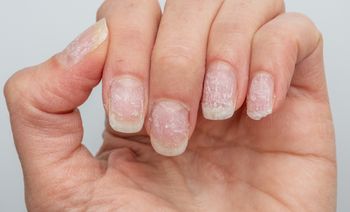 Uratujesz paznokcie po hybrydzie. Weź z kuchni i wetrzyj w płytkę