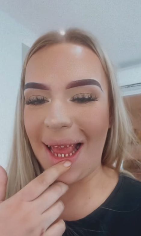 Polka zafundowała sobie "tureckie zęby"