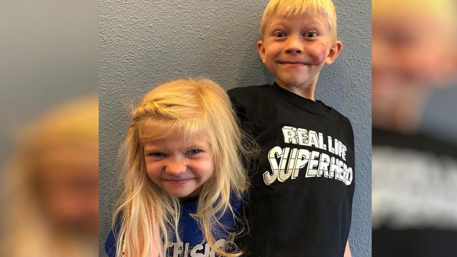 Sześciolatek zasłonił siostrę przed atakiem psa