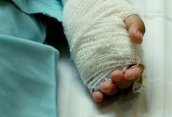 Dwulatek poparzył się ulicznymi halogenami. Ból i cierpienie wyceniono na 300 zł