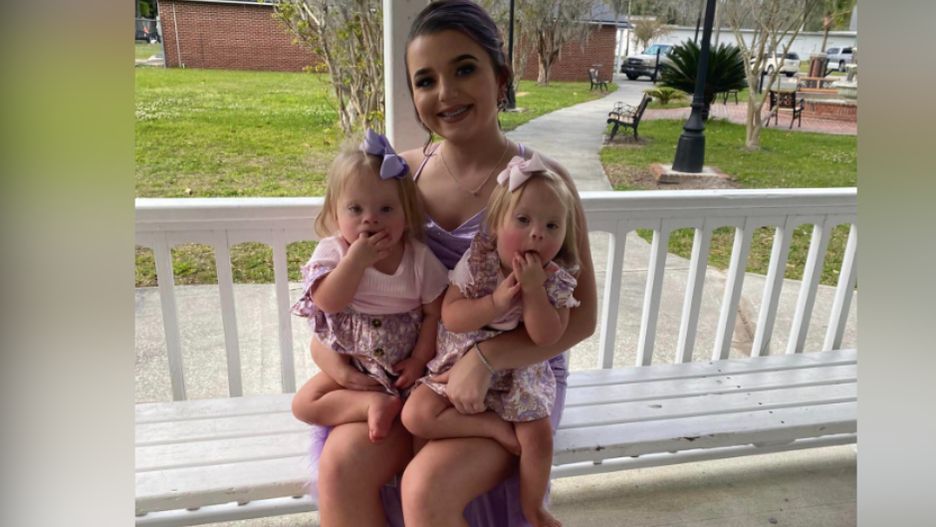 Namawiali ją na aborcję, ale odmówiła. Niedawno bliźniaczki skończyły 3 lata