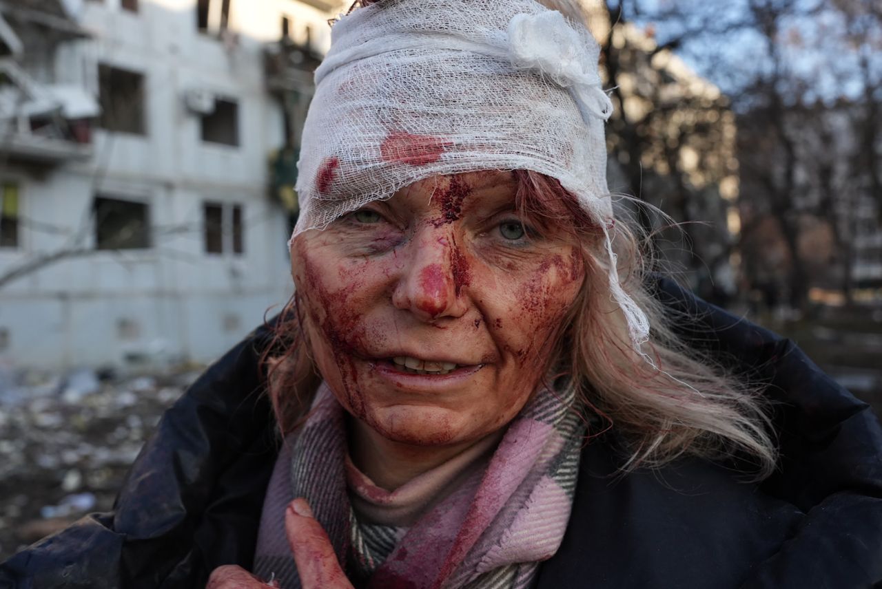 Opatrzona kobieta, która została poważnie raniona podczas ataku na Charków.