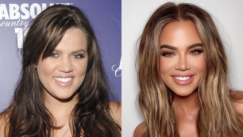 Khloe Kardashian