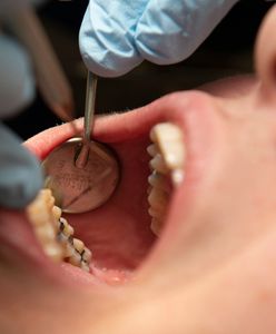Ceny u dentystów wystrzeliły. Duży wzrost stawek