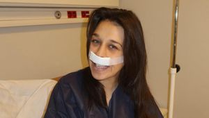 Bała się bólu. Po operacji Jędrzejczyk odezwała się w sieci