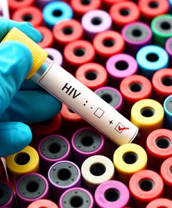 Rusza infolinia dla osób zakażonych HIV. "To odpowiedź na potrzeby osób żyjących z HIV"