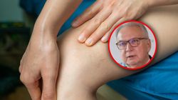 Prowadzi do zakrzepicy. "Dla żył to jest absolutny dramat"