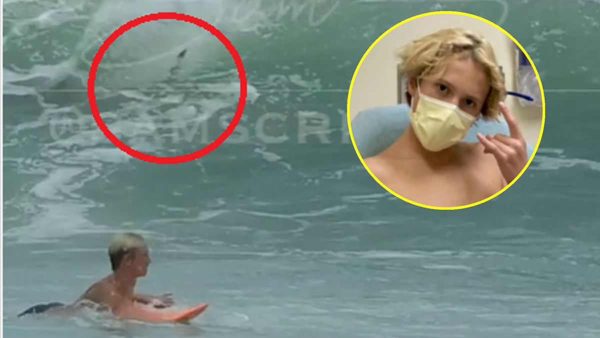 Rekin zaatakował nastoletniego surfera