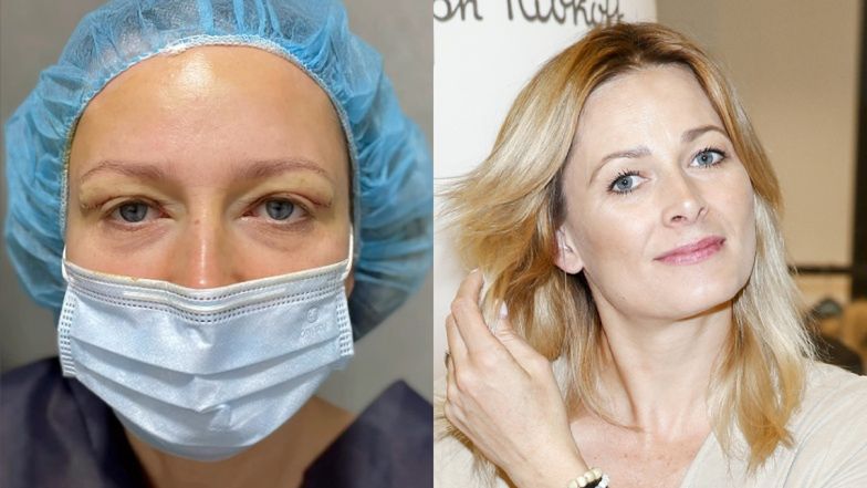 Odeta Moro sprawiła sobie PLASTYKĘ POWIEK. Dziennikarka pokazała efekty na Instagramie: "Te powieki zasłaniały mi świat" (FOTO)