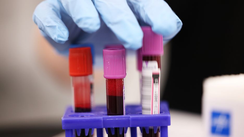 NEW YORK, NEW YORK - AUGUST 13: Blood for testing is placed on a holder at a New York Blood Center's Brooklyn Donor Center  on August 13, 2024 in Downtown Brooklyn in New York City. The American Red Cross reported that there is a shortage of blood in its national blood supply due to the cancelations of more than 100 blood drives nationwide amid high temperatures during the summer.   (Photo by Michael M. Santiago/Getty Images)