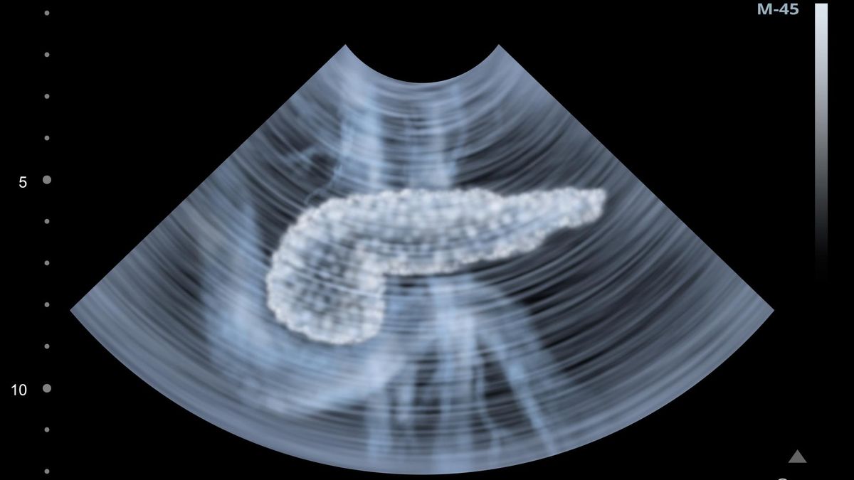 Trzustka wymaga naturalnej regeneracji