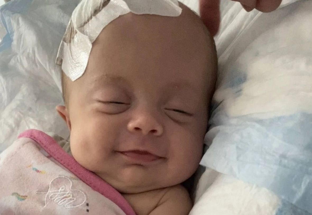 Okazało się, że dziewczynka cierpi na wodogłowie