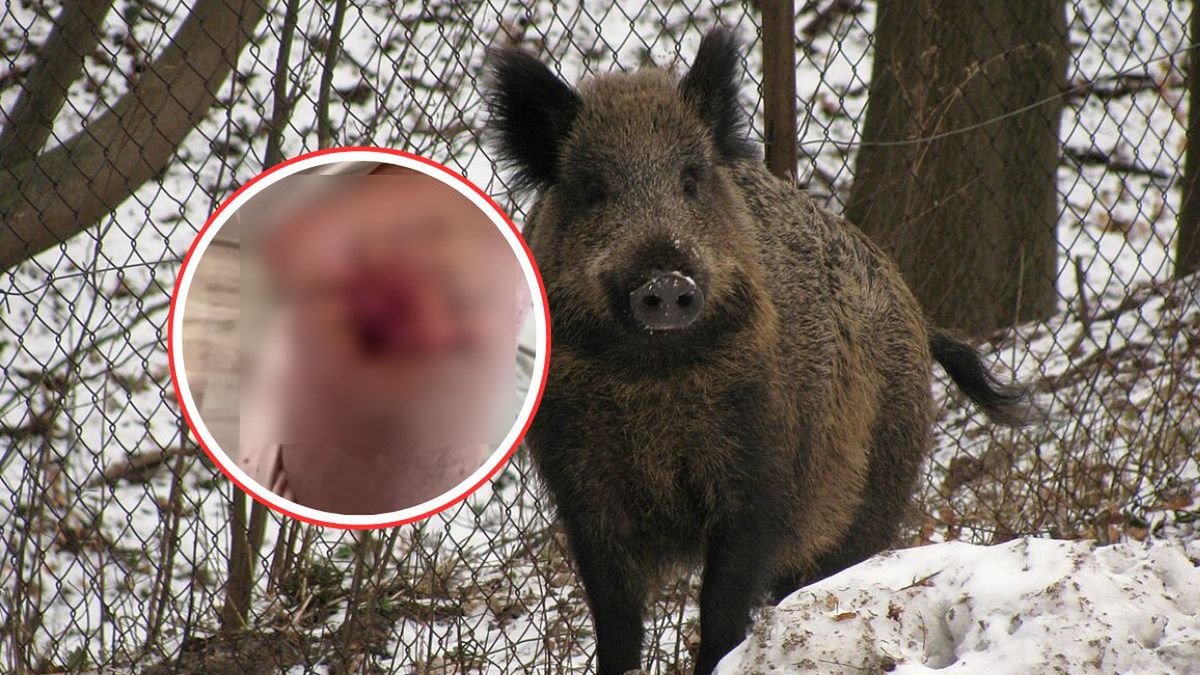 Dzik zaatakował 78-letnią kobietę