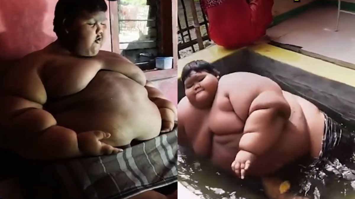 Chłopiec ważył 190 kg