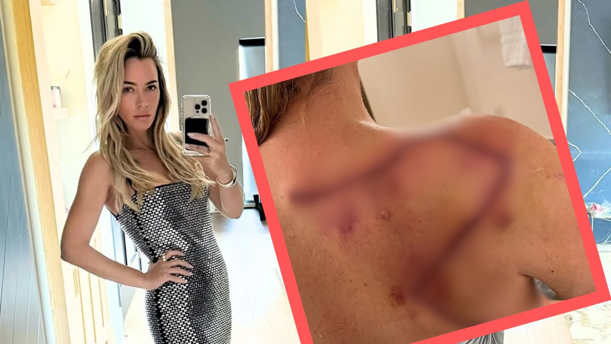 Celebrytka opowiedziała o walce z nowotworem