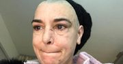 Sinead O'Connor żali się, że POBIŁ JĄ WŁASNY SYN! "Jesteś zwykłym gó*nem, które pobiło własną matkę!"