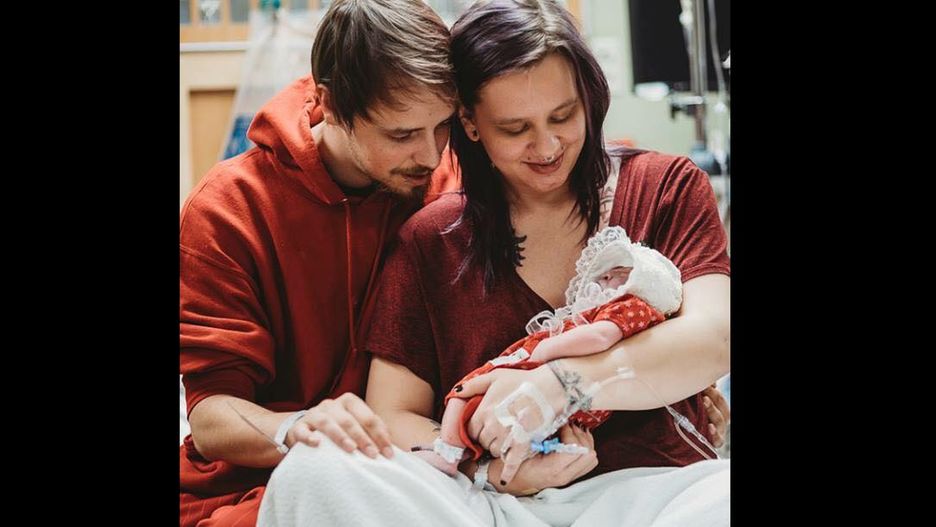 Dziecko urodziło się bez mózgu i części czaszki 