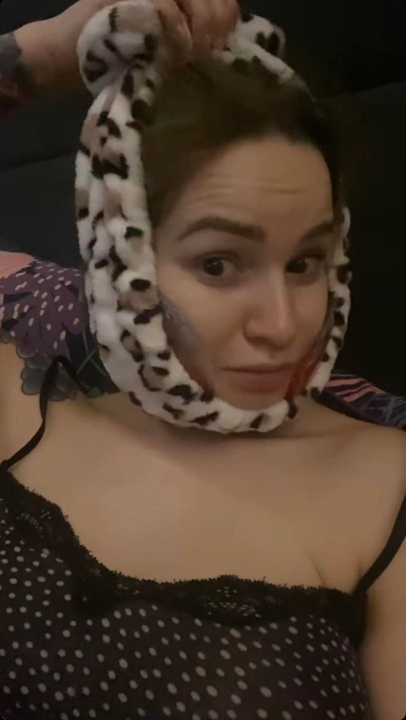 Ewelina Lisowska prezentuje, jak wygląda po zabiegu u dentysty