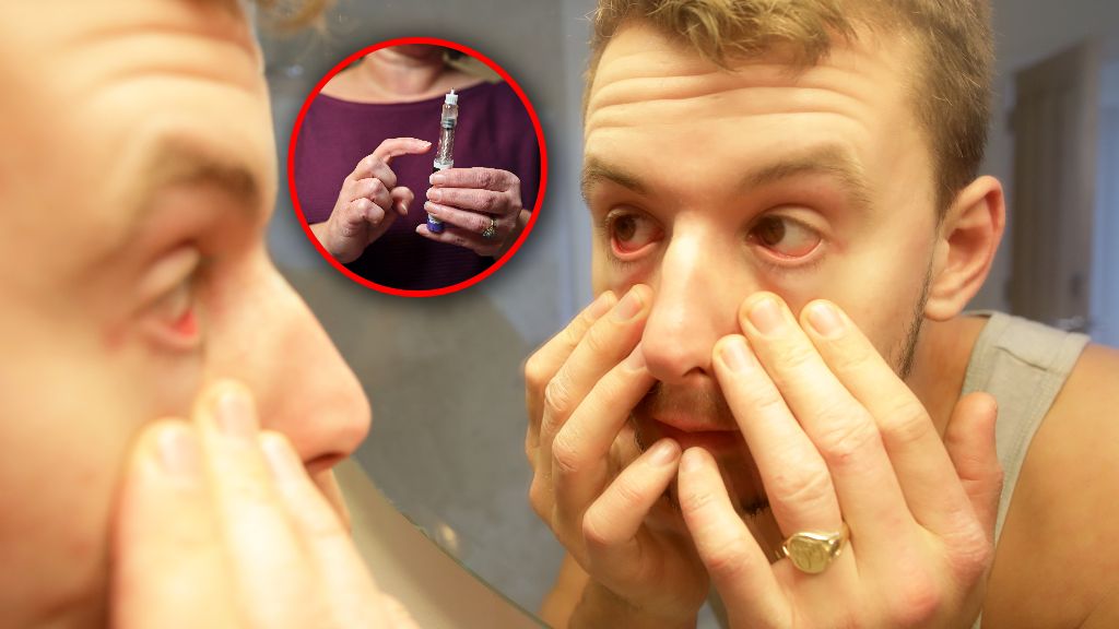 Pięciokrotnie wyższe ryzyko tzw. "udaru oka" przy Wegovy 