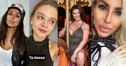 Julia Wróblewska, Natalia Siwiec i Anella, czyli galeria POWIĘKSZONYCH UST polskich celebrytek! (ZDJĘCIA)