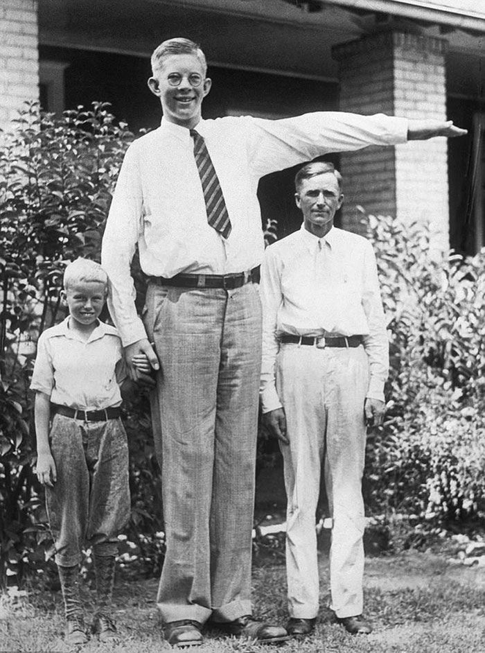 Robert Wadlow miał prawie 3 metry wzrostu. Zobacz historyczne zdjęcia 3