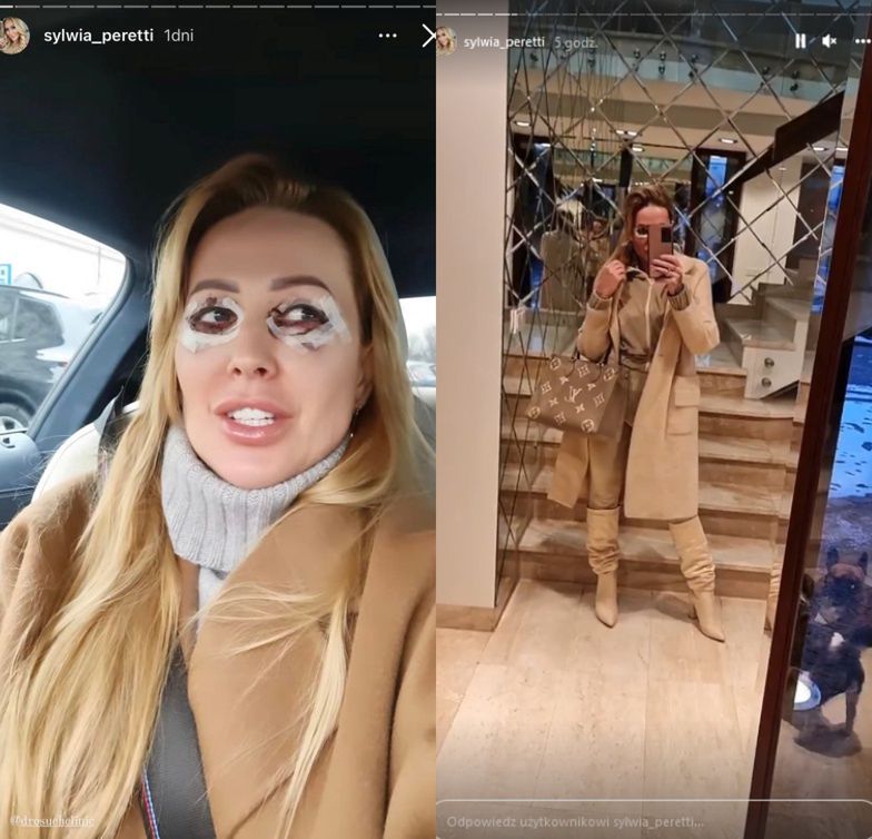 Sylwia Peretti chwali się zabiegiem na powieki