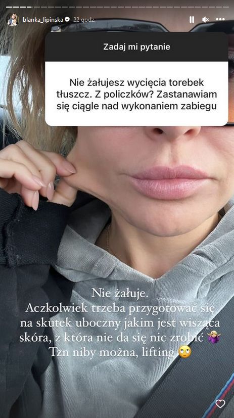 Blanka Lipińska przestrzega przed wycinaniem torebek tłuszczowych z policzków