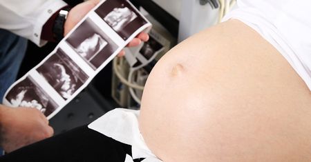 USG ciąży - jak wygląda badanie i kiedy wykonać?