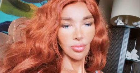 Ewa Minge o liftingu, implantach i modzie na operacje. Ostrzega przed zabiegami w Turcji
