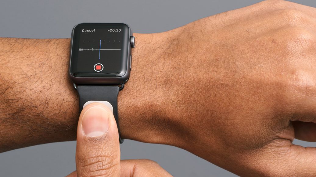 Apple Watch z opaską, która umożliwi pomiar EKG. Czy można ufać takim akcesoriom? Pytamy specjalistę 1