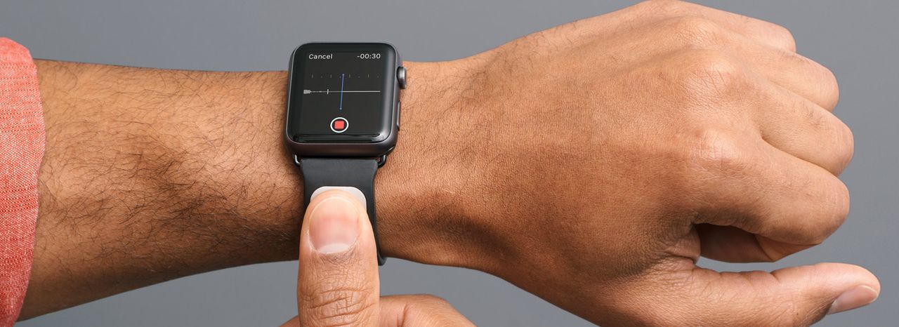 Apple Watch z opaską, która umożliwi pomiar EKG. Czy można ufać takim akcesoriom? Pytamy specjalistę