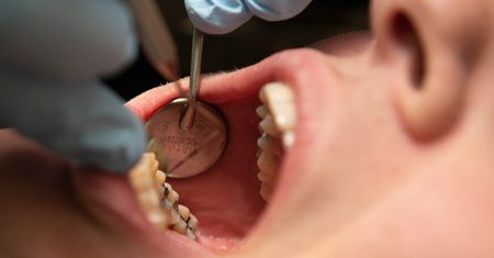 Ceny u dentystów wystrzeliły. Duży wzrost stawek