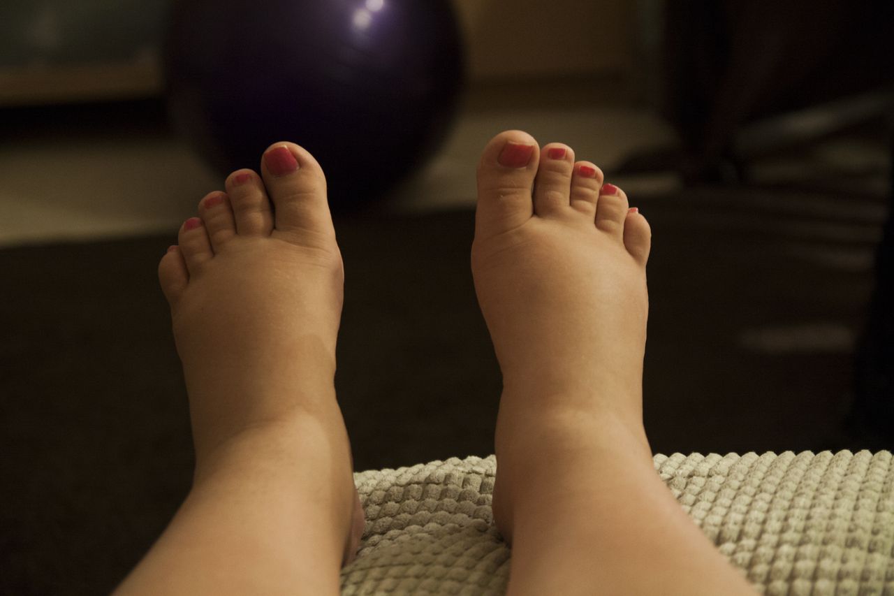 What does swelling around the ankles indicate?