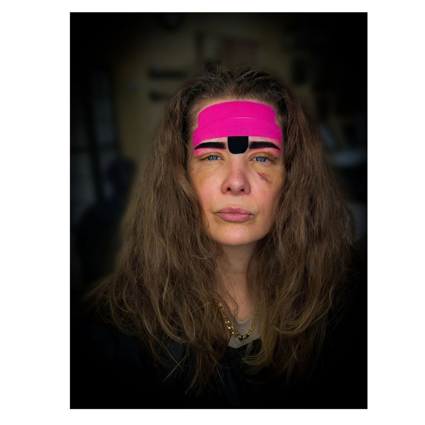 Anna Powierza po zabiegach