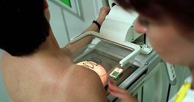 Za mammografię i cytologię zapłacą pracodawcy