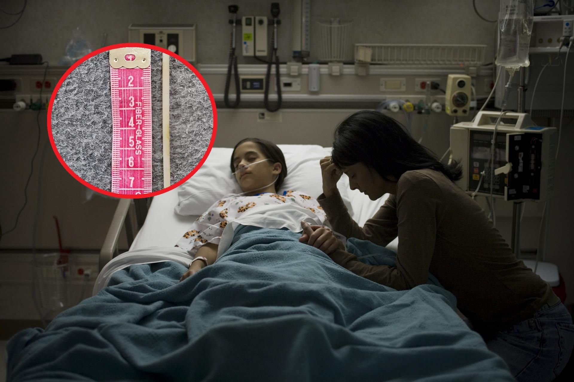 Dziewczynka połknęła lizaka