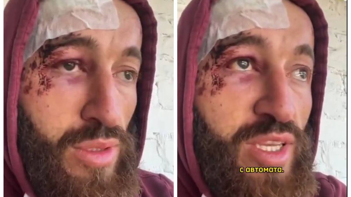 Żołnierz z Osetii został dotkliwie pobity w jednostce. Zrozumiał, że popełnił błąd