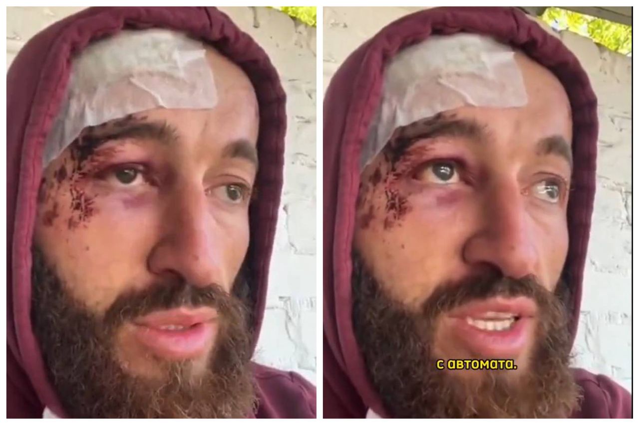 The soldier from Ossetia was severely beaten in the unit. He understood that he made a mistake.
