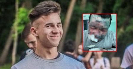 To ta sama osoba na obu zdjęciach. Cudem przeżył atak Rosjan