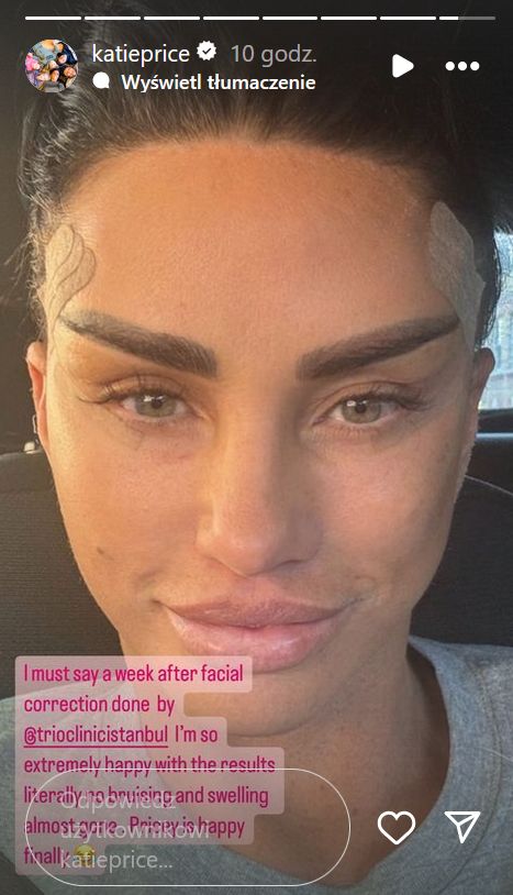 Katie Price shows off the results of the procedure