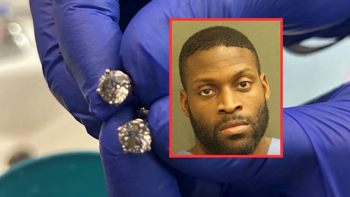 Policja z Orlando wyjęła z ciała podejrzanego skradzione fanty