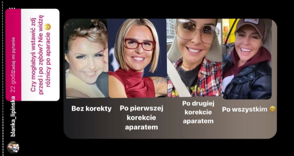 Metamorfoza Blanki Lipińskiej