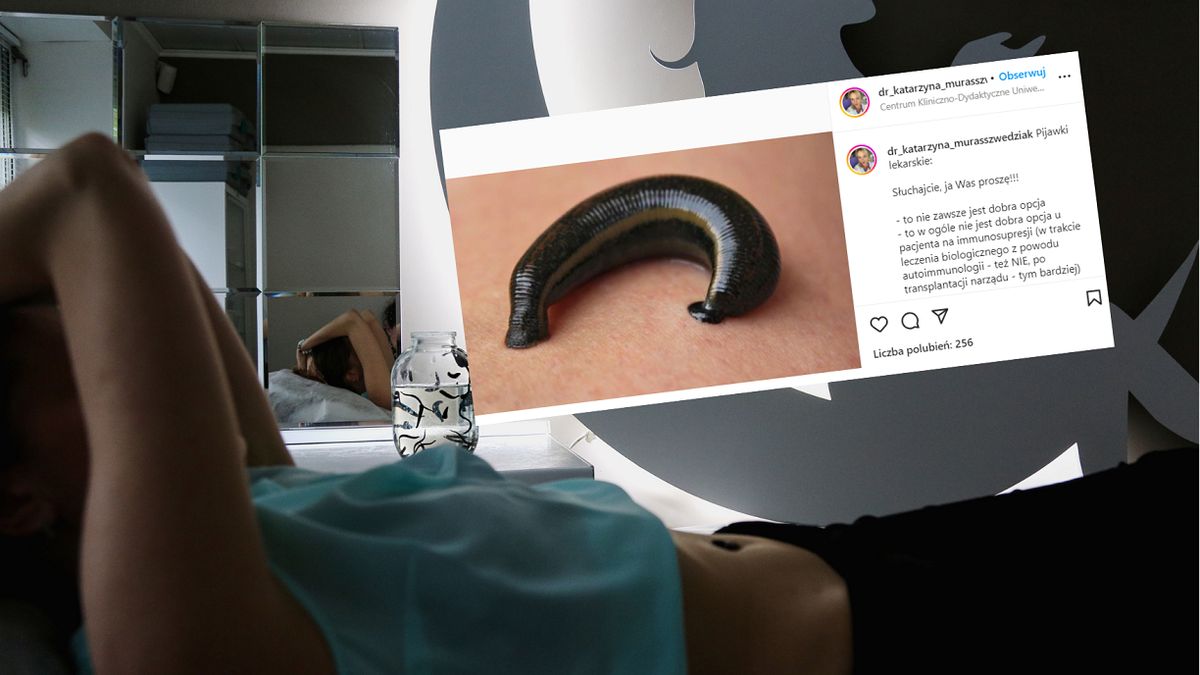 Lekarka ostrzega przed kuracją pijawkami. Jest szczególnie niebezpieczna dla jednej grupy pacjentów
