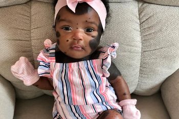 "Dziewczynka panda" jest znana na całym świecie. Oto jak dziś wygląda